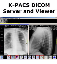 K-PACS Free DiCOM Server and Viewer
