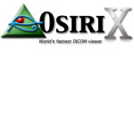 Osirix PACS DICOM Viewer for Healthcare